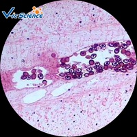 Popular Set of Student Medical Parasitology Slides(50 Kinds) Schistosome Microscope Slide Amoeba Teaching Slides