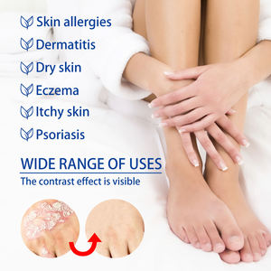 Crème à base de plantes 20g pour le psoriasis, l'acné, la dermatite, l'eczéma du scrotum, la pityriasis, l'urticaire, certifiée pour l'eczéma du scrotum - Product Image 3
