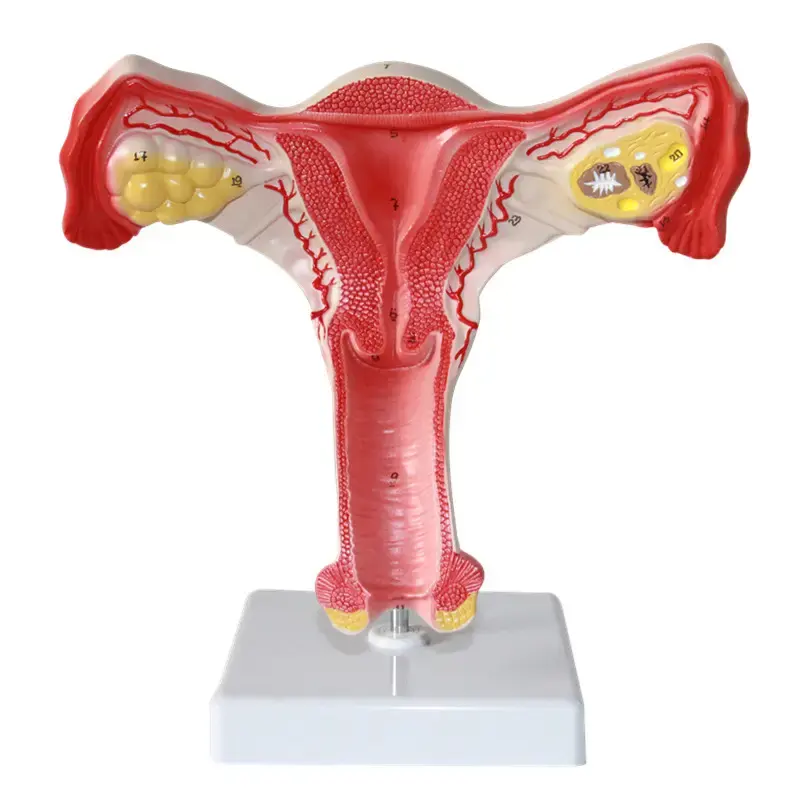 Lehr modell der weiblichen Uterus anatomie Uterus anatomisches Modell