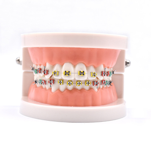 Modelo Dental Portátil de PVC para Enseñanza de Ortodoncia con Aparatos Ortodóncicos - Product Image 1