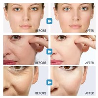 Soins de la peau de marque privée Hydraulique Humide Élimination de l'acné Anti-âge Sérum réparateur Peptides Acide hyaluronique Sérum blanchissant