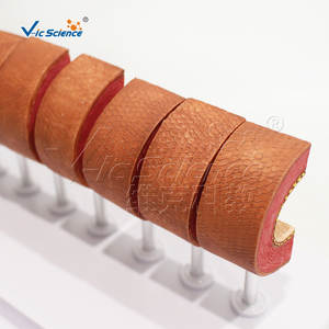 Modelo de <span class=keywords><strong>Arteriosclerosis</strong></span> con Tarjeta de Instrucciones, Modelo Anatómico de Lesiones Vasculares para <span class=keywords><strong>la</strong></span> Educación sobre <span class=keywords><strong>la</strong></span> Salud Cardiovascular - Product Image 2