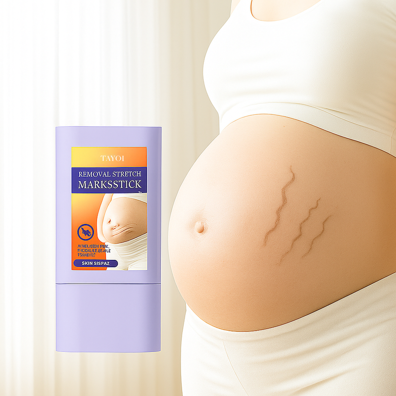 High Quality Organic Stretch Mark Removal
