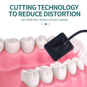 Sensore di Imaging dentale professionale adatto per cliniche dentali Clear Imaging migliorare l'efficienza diagnostica - Product Image 3