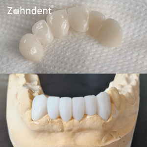 Zahndent Nhà Máy Trực Tiếp Giá 43% Độ Trong mờ 1200mpa Độ Bền Uốn St Nha Khoa Zirconia Khối - Product Image 4
