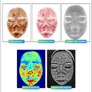 2026년 핫셀링 전문 3D AI 피부 분석기 8-스펙트럼 UV 감지 EU/US 플러그 - Product Image 4