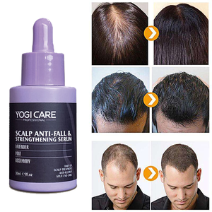 Aceite Esencial de Lavanda para el Crecimiento del Cabello, Nutritivo, Anticaída, Cuidado del Cuero Cabelludo, Suero Capilar - Product Image 4
