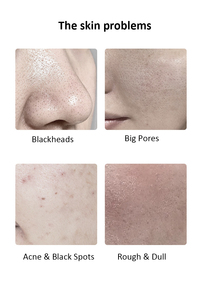 Professionelle Salon-Spa-Gesichtsmassagecreme mit natürlicher Rosenessenz für weißere, strahlendere und glänzende Haut - Product Image 2