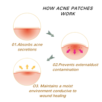 Patchs Hydrocolloïdes en Forme de Cœur pour l'Acné, Réparation Invisible des Imperfections, Décoration pour Fêtes et Festivals, Personnalisation ODM/OEM en Usine