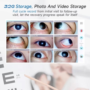 Ophthalmic Equipment 1X Magnification M-970B Portable Low Price for Mobile Eye Screening Exam at the Clinic - Product Image 4