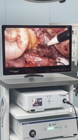 Tour d'endoscopie laparoscopique IKEDA YKD-9007 pour chirurgie endoscopique multi-specialités