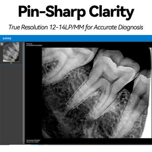 Sensor de Imagen Digital Profesional para Uso <span class=keywords><strong>Dental</strong></span> y Hospitalario, Alta Claridad, Fácil Operación, <span class=keywords><strong>Precio</strong></span> Accesible - Product Image 2