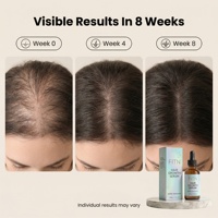 Sérum de croissance capillaire à la biotine et au romarin, peptide naturel, pour un cuir chevelu plus épais et plus fort, nourrissant, sans prostaglandine, OEM, étiquette privée
