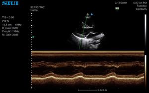 Ecógrafo Veterinario SIUI Apogee 1000 Lite, el Más Vendido, Portátil, con Doppler a Color y Pantalla de 15 Pulgadas - Product Image 5