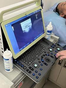 Ultrassom 4d de ultrassom doppler de cor para máquina de gyne e obs para gravidez - Product Image 4