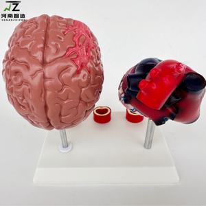 หุ่นจำลองสาธิตการสอนโรคหัวใจและหลอดเลือด โรคหลอดเลือดสมอง ขนาดเท่าคนจริง วัสดุ PVC คุณภาพสูง สำหรับการศึกษาทางการแพทย์ - Product Image 4