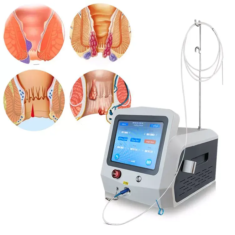 Diode Laser 1470nm Aambeien Fistel Laser Chirurgie 980nm Proctology Anorectale Laser Medische Machine