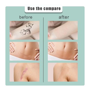 Stiker tato <span class=keywords><strong>Concealer</strong></span> warna kulit 1 rol, stiker tato penutup tato pembakar bekas luka, plester tidak terlihat tahan air - Product Image 5