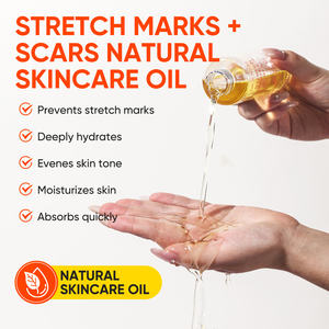 Crème efficace et rapide pour l'élimination des cicatrices, biologique, sans danger pour les femmes enceintes, soin de la peau naturel, hydratant, OEM MOOYAM, crème anti-vergetures - Product Image 6