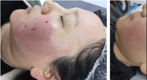 Youmii gluan Trehalose perbaikan masker seprai pelembap anti-peradangan untuk perawatan rumah akselerasi penyembuhan luka semua jenis kulit - Product Image 3