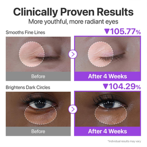 Crema de Ojos Coreana Eléctrica con NAD+, Péptidos Retinales y Niacinamida para Iluminar las <span class=keywords><strong>Ojeras</strong></span>, Gel Aclarante para Ojos, Fórmula Antiarrugas - Product Image 4