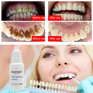 Poudre <span class=keywords><strong>de</strong></span> sérum d'essence <span class=keywords><strong>de</strong></span> blanchiment des <span class=keywords><strong>dents</strong></span> sérum nettoyant d'hygiène buccale liquide <span class=keywords><strong>de</strong></span> blanchiment des <span class=keywords><strong>dents</strong></span> <span class=keywords><strong>pour</strong></span> des <span class=keywords><strong>dents</strong></span> - Product Image 4