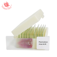 Plasmodium Vivax Microscope Slides Medical Science Parasitology Prepared Slides Microscope Prepared Slides