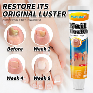 Crème antifongique pour ongles à base de plantes, pommade pour les ongles des orteils, pommade réparatrice pour Tinea Unguium - Product Image 4