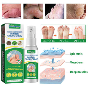 Spray para Hongos, Dermatitis y Callosidades South Moon: Cuidado Hidratante para Manos y <span class=keywords><strong>Pies</strong></span>, Alivia Bolitas, Olor y Picazón - Product Image 1