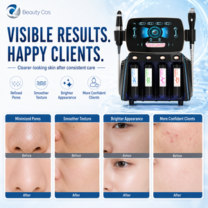 Appareil de soin du visage de bureau, hydro-facial avec technologie d'aspiration pour un nettoyage en profondeur des pores, une infusion d'oxygène et une hydratation de la peau - Product Image 4