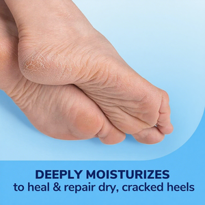 Stick Réparateur pour les Pieds - Baume à l'Urée Sans Parfum pour Pieds Sensibles, Démangeaisons et Desquamation - Exfoliation Douce et Maintien de l'Hydratation - Product Image 6