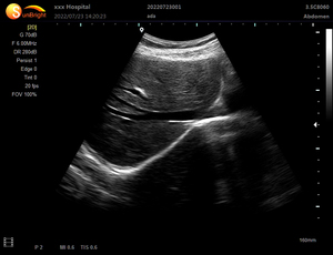 Échographe portable médical à bas prix avec écran LCD 12,1 pouces et double prise pour ordinateur portable - Product Image 6