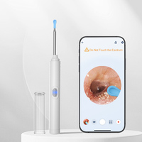 Nettoyeur d'oreilles visuel WiFi avec caméra HD 1296P, 6 LED, avertissement de sécurité du tympan, lentille fine 3,5 mm, cuillère en silicone, compatible iOS et Android, cadeau OEM