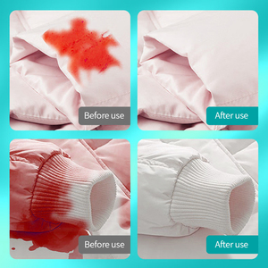 Mousse nettoyante pour doudoune Getsun pour enlever les taches sur les tissus de vêtements, douce, sans eau, lavage <span class=keywords><strong>à</strong></span> haute mousse, nettoyant pour vêtements - Product Image 5