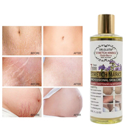 Huile Corporelle Anti-Vergetures OEM – Réparation en 7 Jours, Atténuation des Cicatrices et Taches Brunes, Anti-Rides, Double Action Éclaircissante et Blanchissante – Huile Essentielle