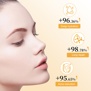 Espuma Limpiadora <span class=keywords><strong>Facial</strong></span> OEM/ODM, 3 Tipos: Leche, Colágeno y Arroz, Limpieza Profunda, 150 ml, Marca Privada MOOYAM - Product Image 2