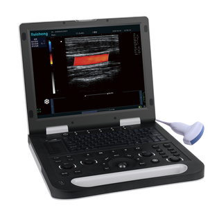 Ecografo Digitale Cardiale Echografie Machine Kleur <span class=keywords><strong>Doppler</strong></span> 3d 4d Veterinaire Diagnostische Scanner Medische Echo Echografie Pr - Product Image 1
