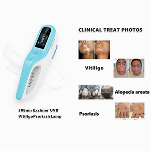 Dispositivo Láser Excimer de 308nm con Certificación CE para Terapia de Despigmentación del Vitiligo, Recargable y Portátil - Product Image 1