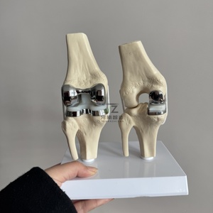 Nuevo modelo de prótesis de rodilla artificial desmontable 2025, conjunto de modelo de implante de articulación de rodilla doble pequeña plateada - Product Image 2