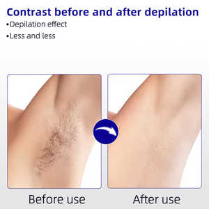 Cartuccia Roll-on <span class=keywords><strong>per</strong></span> <span class=keywords><strong>Depilazione</strong></span> con Cera di Aloe Vera Naturale 100ml Ricaricabile, Etichetta Privata Best Seller - Product Image 3