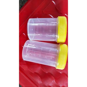 ถ้วยเก็บปัสสาวะพลาสติกแบบมีฝาเกลียว ขนาด 40 มล. ของมหาวิทยาลัยการแพทย์ซูโจว - Product Image 2