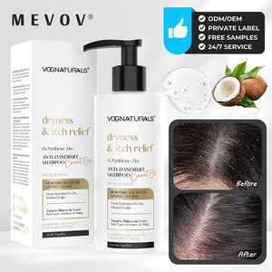 <span class=keywords><strong>แชมพู</strong></span>ขจัดรังแค1% น้ำมันมะพร้าวสังกะสี pyrithione ผสมเพื่อให้ความชุ่มชื้นแห้งและบรรเทาอาการคันฉลากส่วนตัว - Product Image 1