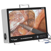 Système de caméra endoscopique chirurgicale compacte Full HD pour salle d'opération, chirurgie laparoscopique