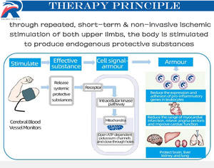 Malattia ischemica Trainer made in china portatile <span class=keywords><strong>braccio</strong></span> LCD ischemico dispositivo di formazione precondizionamento dispositivo di formazione - Product Image 4