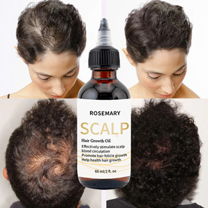 Huile de croissance des cheveux nutritionnelle sérum liquide de soin du cuir chevelu pour <span class=keywords><strong>Essence</strong></span> pour soin des cheveux huile de soin des cheveux essentielle - Product Image 4