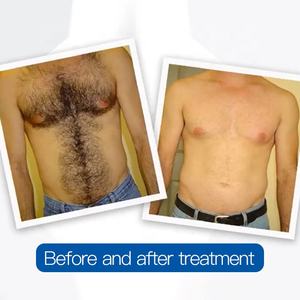 <span class=keywords><strong>Prix</strong></span> usine 3000W haute poignée sans puissance pointe faciale diode <span class=keywords><strong>laser</strong></span> épilation machine 755 + 808 + 1064 3 longueur d'onde pour toutes les peaux - Product Image 4