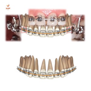 UM medical Niti محور عزم الجذر الأمامي مقوس مساعد خماسية منحنيين زنبرك لربطات أسلاك الأسنان مقاس صغير/ متوسط/ كبير - Product Image 6