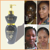 OEM Lotion Corporelle Éclaircissante Végétalienne Biologique à l'Acide Hyaluronique VIP Luxe Gluta Rose Thérapie Blanchissant la Peau pour Peaux Noires