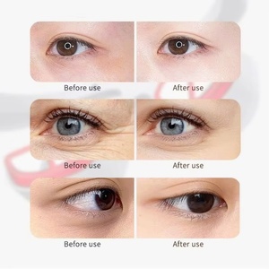 Masseur oculaire à lumière rouge personnalisé avec logo, compresse chaude, anti-rides, élimination des cernes, appareil de beauté pour les yeux 3D - Product Image 6