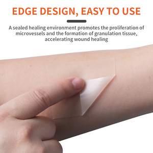 Apósito hidrocoloide en rollo de 0.3mm de grosor, color piel, para cobertura de heridas, autoadhesivo - Product Image 5